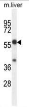 TBCC Domain Containing 1 antibody, AP54175PU-N, Origene, Western Blot image 