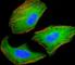 TSC Complex Subunit 2 antibody, F40275-0.4ML, NSJ Bioreagents, Western Blot image 