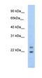 Cytoplasmic polyadenylated homeobox antibody, orb324718, Biorbyt, Western Blot image 