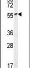 ALG10 Alpha-1,2-Glucosyltransferase B antibody, PA5-25540, Invitrogen Antibodies, Western Blot image 