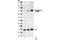 LCK Proto-Oncogene, Src Family Tyrosine Kinase antibody, 2751S, Cell Signaling Technology, Western Blot image 