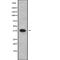 Interferon Stimulated Exonuclease Gene 20 Like 2 antibody, abx216321, Abbexa, Western Blot image 