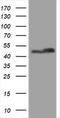 SERPINE1 MRNA Binding Protein 1 antibody, M04755, Boster Biological Technology, Western Blot image 