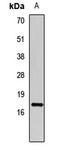 Caveolin 3 antibody, LS-C668401, Lifespan Biosciences, Western Blot image 
