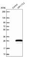 MPV17 Mitochondrial Inner Membrane Protein Like 2 antibody, NBP1-84668, Novus Biologicals, Western Blot image 