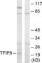 Tumor necrosis factor alpha-induced protein 8 antibody, TA315288, Origene, Western Blot image 