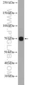 CD226 Molecule antibody, 17842-1-AP, Proteintech Group, Western Blot image 