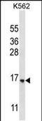 StAR Related Lipid Transfer Domain Containing 5 antibody, PA5-48459, Invitrogen Antibodies, Western Blot image 