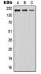 Microtubule Associated Serine/Threonine Kinase 2 antibody, LS-B13628, Lifespan Biosciences, Western Blot image 