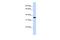 Vestigial Like Family Member 3 antibody, A14125, Boster Biological Technology, Western Blot image 