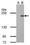 Tet Methylcytosine Dioxygenase 3 antibody, GTX628257, GeneTex, Western Blot image 