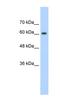 Synaptotagmin Binding Cytoplasmic RNA Interacting Protein antibody, NBP1-57197, Novus Biologicals, Western Blot image 