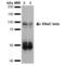 Sodium Channel Epithelial 1 Beta Subunit antibody, LS-C774312, Lifespan Biosciences, Western Blot image 