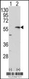 Matrix Metallopeptidase 13 antibody, 62-170, ProSci, Western Blot image 