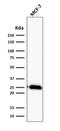 CPN10 antibody, AE00105, Aeonian Biotech, Western Blot image 
