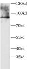 Vav Guanine Nucleotide Exchange Factor 3 antibody, FNab10378, FineTest, Western Blot image 