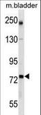 Glutamate-Cysteine Ligase Catalytic Subunit antibody, LS-B11794, Lifespan Biosciences, Western Blot image 