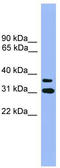 Olfactory Receptor Family 2 Subfamily D Member 3 antibody, TA342708, Origene, Western Blot image 