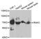 Interleukin 1 Receptor Associated Kinase 3 antibody, TA332705, Origene, Western Blot image 