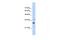 Nicotinamide Nucleotide Adenylyltransferase 1 antibody, PA5-43246, Invitrogen Antibodies, Western Blot image 