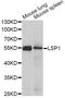 Lymphocyte Specific Protein 1 antibody, A5617, ABclonal Technology, Western Blot image 