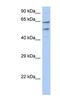 Transmembrane And Coiled-Coil Domain Family 3 antibody, NBP1-91338, Novus Biologicals, Western Blot image 