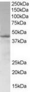 SAM Domain, SH3 Domain And Nuclear Localization Signals 1 antibody, TA302597, Origene, Western Blot image 
