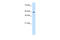 Zinc Finger Protein 213 antibody, 28-336, ProSci, Western Blot image 