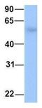 3-Oxoacid CoA-Transferase 2 antibody, GTX46174, GeneTex, Western Blot image 