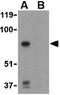 Serine/Threonine Kinase 11 antibody, GTX31753, GeneTex, Western Blot image 