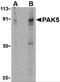 P21 (RAC1) Activated Kinase 5 antibody, 3075, ProSci, Western Blot image 