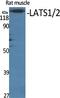 Large Tumor Suppressor Kinase 1 antibody, A01051-1, Boster Biological Technology, Western Blot image 