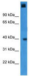 General Transcription Factor IIA Subunit 1 antibody, TA329243, Origene, Western Blot image 