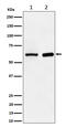 Arginyltransferase 1 antibody, M07459, Boster Biological Technology, Western Blot image 