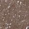 Somatostatin Receptor 2 antibody, NBP2-48508, Novus Biologicals, Immunohistochemistry frozen image 