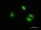 Clathrin Light Chain B antibody, LS-C133126, Lifespan Biosciences, Immunofluorescence image 