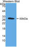Endothelial Cell Adhesion Molecule antibody, LS-C374826, Lifespan Biosciences, Western Blot image 