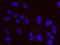 RB Binding Protein 8, Endonuclease antibody, NB100-79810, Novus Biologicals, Proximity Ligation Assay image 
