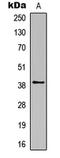 Rhodopsin antibody, LS-C368503, Lifespan Biosciences, Western Blot image 