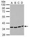 Purinergic Receptor P2Y12 antibody, GTX108143, GeneTex, Western Blot image 