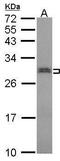 Small nuclear ribonucleoprotein-associated protein N antibody, PA5-30225, Invitrogen Antibodies, Western Blot image 