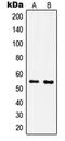 Inositol-Pentakisphosphate 2-Kinase antibody, MBS821471, MyBioSource, Western Blot image 