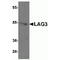 Lymphocyte activation gene 3 protein antibody, TA355030, Origene, Western Blot image 