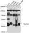 TRNA Methyltransferase 2 Homolog B antibody, A16400, Boster Biological Technology, Western Blot image 