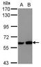 Myocyte-specific enhancer factor 2D antibody, GTX117552, GeneTex, Western Blot image 