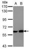 Myocyte Enhancer Factor 2D antibody, GTX117552, GeneTex, Western Blot image 