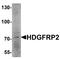 Hepatoma-derived growth factor-related protein 2 antibody, A32401, Boster Biological Technology, Western Blot image 