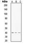 TERF1 Interacting Nuclear Factor 2 antibody, MBS821551, MyBioSource, Western Blot image 