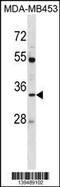 Aquaporin 3 (Gill Blood Group) antibody, 60-438, ProSci, Western Blot image 