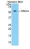 Lipase C, Hepatic Type antibody, LS-C299083, Lifespan Biosciences, Western Blot image 